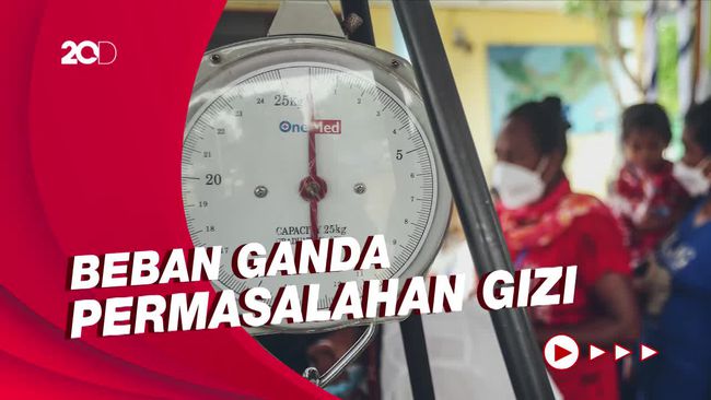 Permasalahan Gizi di Indonesia, Stunting dan Obesitas Jadi Sorotan