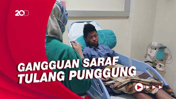 Kata Dokter soal Anak Lumpuh Usai Divaksin Covid-19 di Sulsel