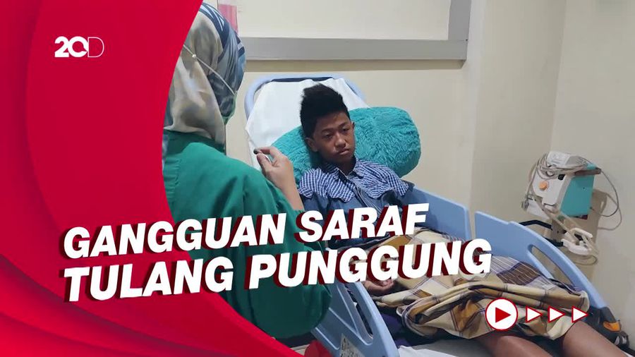 Kata Dokter soal Anak Lumpuh Usai Divaksin Covid-19 di Sulsel