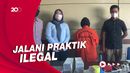 Polisi Bongkar Praktik Dokter Kecantikan Gadungan di Padang