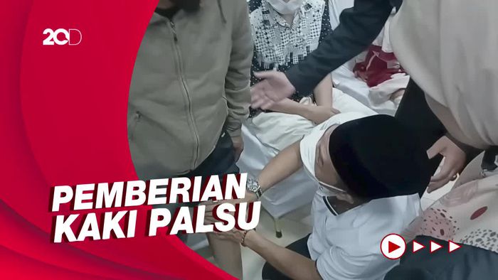Bahagia Petani Bawang asal Bandung Dapatkan Kaki Palsu