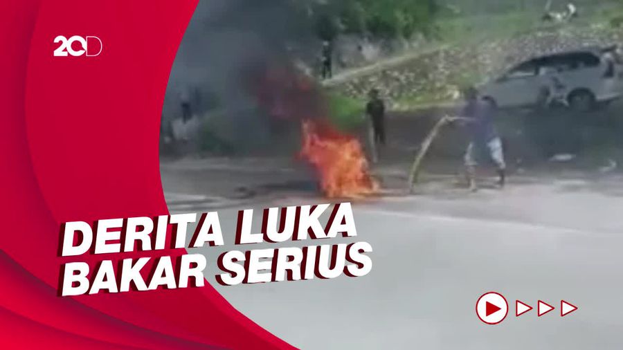 Lansia di Polman Luka Parah Gegara Motornya Terbakar Akibat Kecelakaan