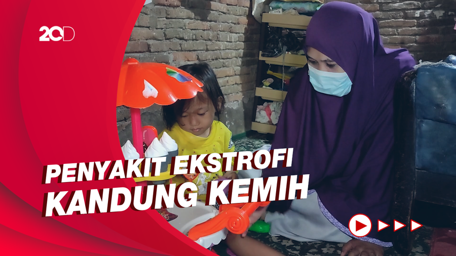 Perjuangan Bocah Sulsel Lawan Penyakit Langka Sejak Lahir