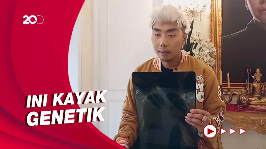 Roy Kiyoshi Syok Didiagnosa Pembengkakan Jantung 