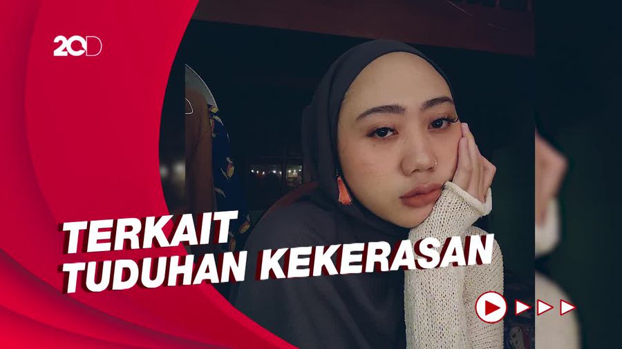 Usai Kisahnya Viral, Aya Canina Eks Amigdala Dapat Kiriman Pesan