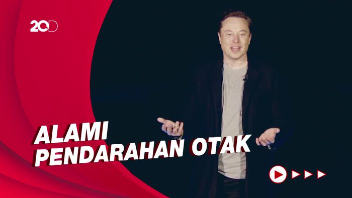Dilaporkan 15 Monyet yang Ditanami Chip Otak Neuralink Elon Musk Mati