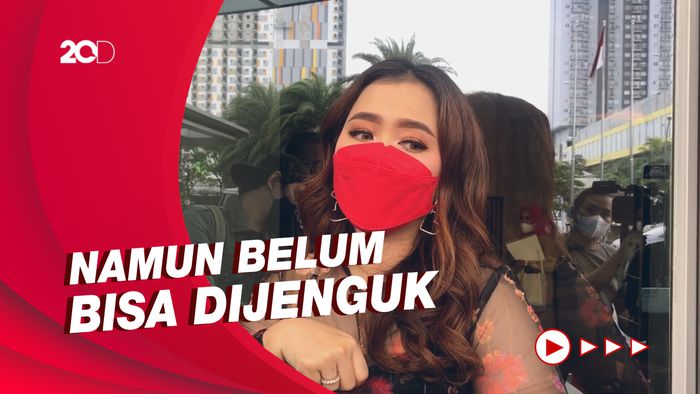 Kondisi Terkini Tukul Arwana