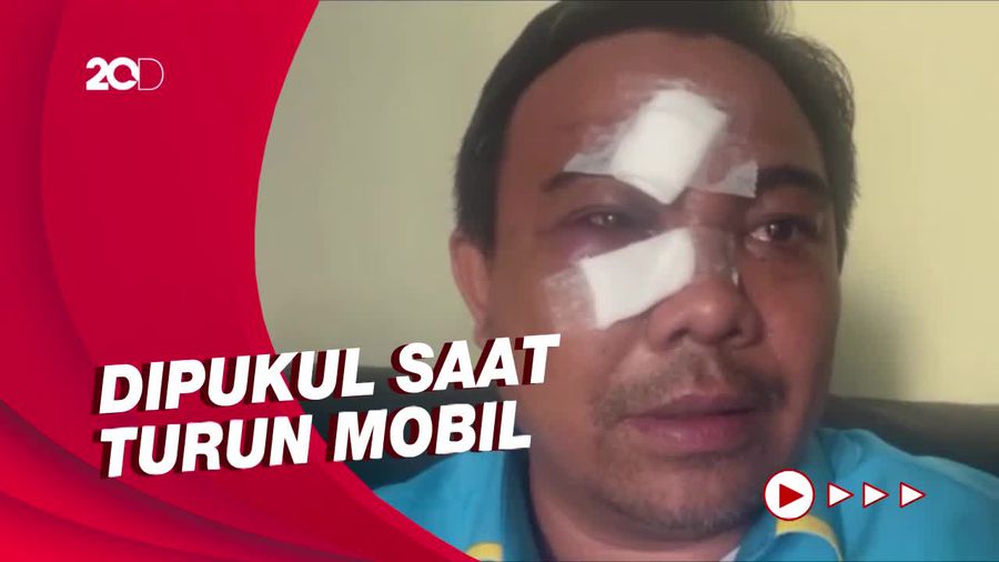 Kronologis Pengeroyokan Ketum KNPI Haris Pertama