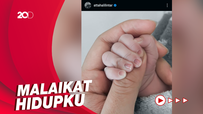 Kabar Bahagia! Aurel Hermansyah Sudah Melahirkan