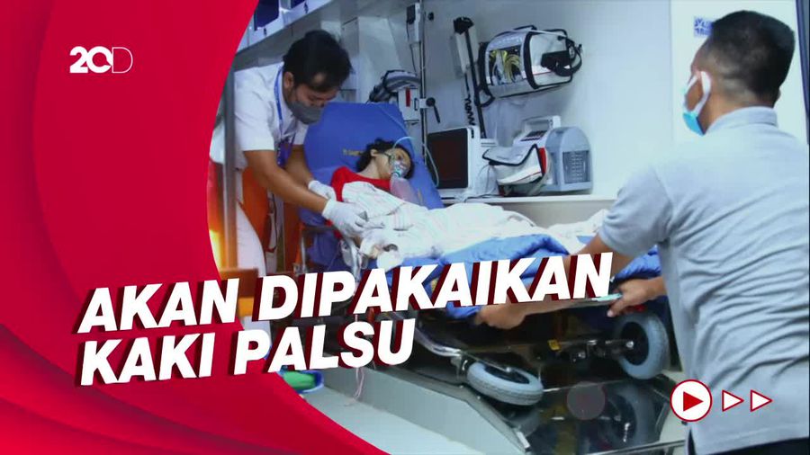RSCM Sebut Pengobatan Sinta Usai Operasi Tumor Selesai dalam 4 Bulan