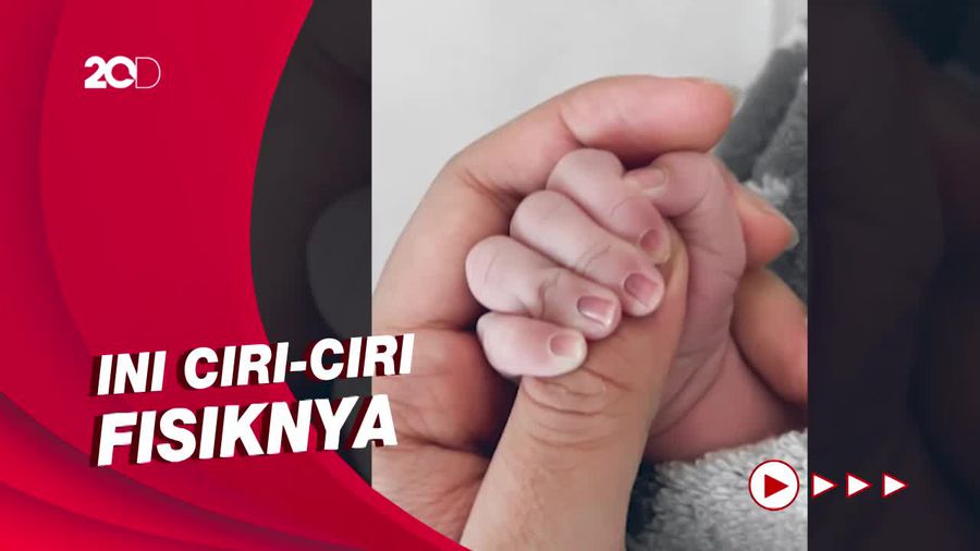 Atta Halilintar Umumkan Nama Baby A Besok