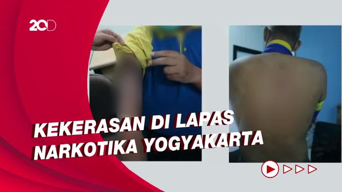 Temuan Komnas HAM soal Lapas Yogya: Napi Dipukul Pakai Kelamin Sapi