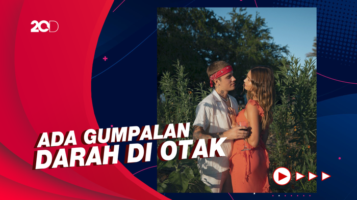 Hailey Bieber Sempat Dilarikan ke RS Karena Gejala Mirip Stroke