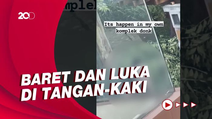 Polisi Ungkap Hasil Visum Anak yang Dianiaya ART di Jakbar