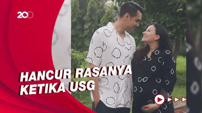 Asmirandah Keguguran, Jonas Rivanno: Tuhan Tahu yang Terbaik