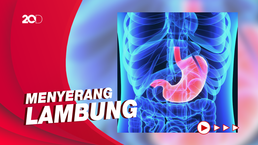 Waspadai Ciri Penyakit Asam Lambung dan GERD