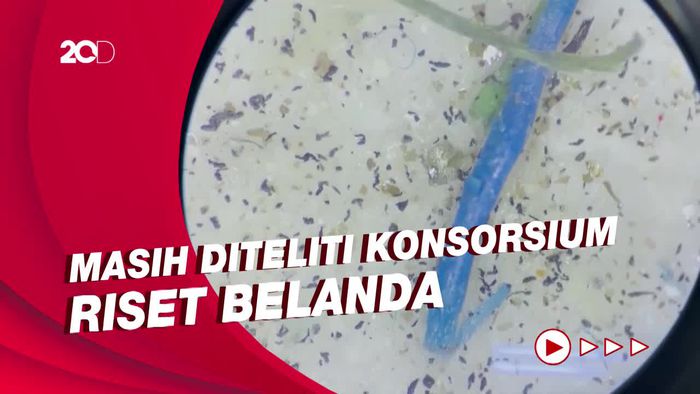 Pertama Kalinya! Mikroplastik Ditemukan di Pembuluh Darah Manusia