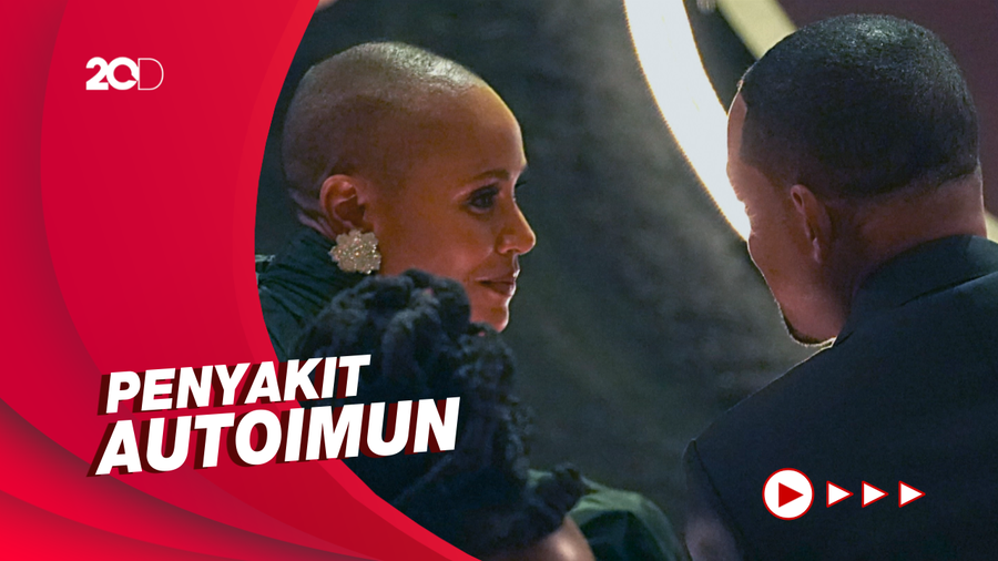 Alasan Alopecia yang Diidap Jada Pinkett Bukanlah Lelucon