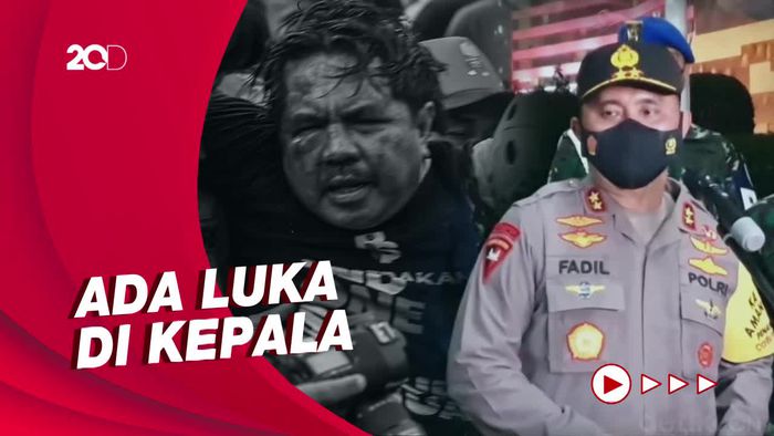 Polisi: Kondisi Ade Armando Cukup Memprihatinkan