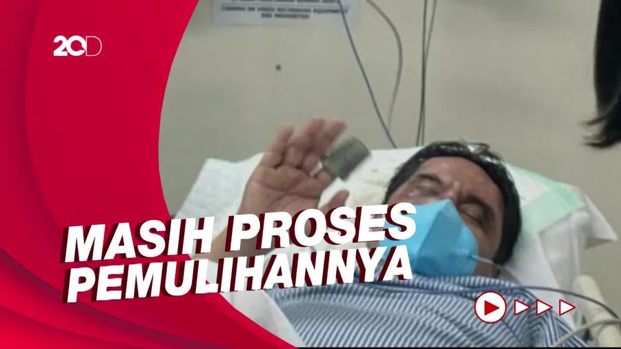 Masih Dirawat di Ruang HCU, Ade Armando Sudah Bisa Tertawa