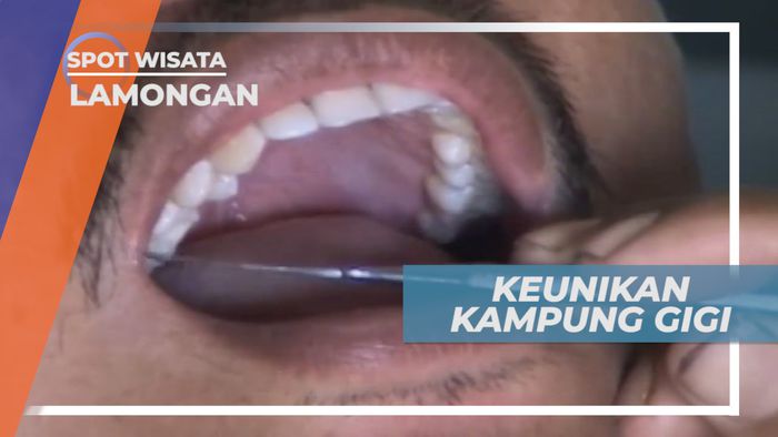 Berkunjung ke Kampung Gigi Lamongan Jawa Timur