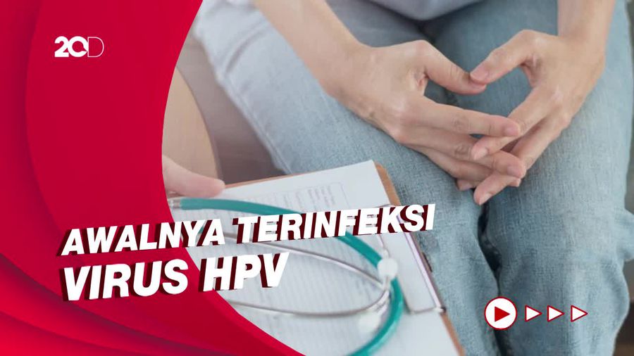 Kanker Serviks, Kanker Reproduksi Wanita yang Bisa Dicegah