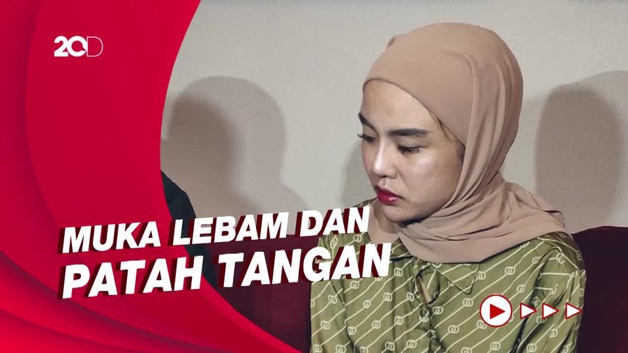 3 Kali Alami KDRT, Medina Zein Resmi Polisikan Lukman Azhari