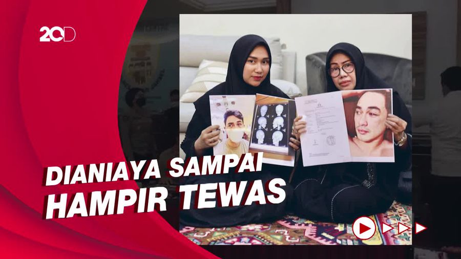 Unggah Foto Rico Valentino Babak Belur, Istri Putra Siregar Ingin Keadilan