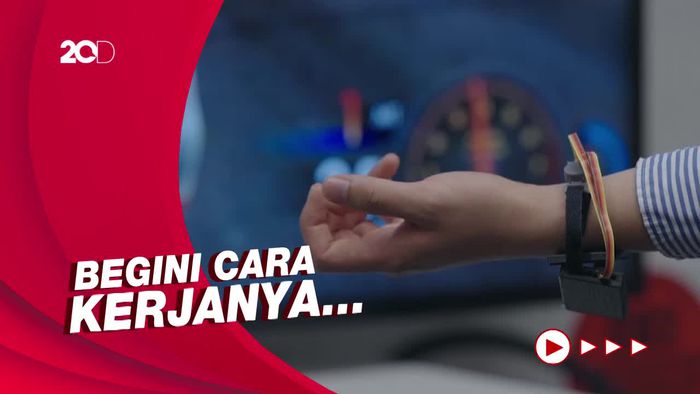 Peneliti Ciptakan Gelang Sensor untuk Bantu Pengidap Cerebral Palsy