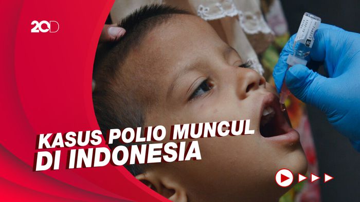 Pentingnya Vaksin untuk Cegah Penyebaran Polio