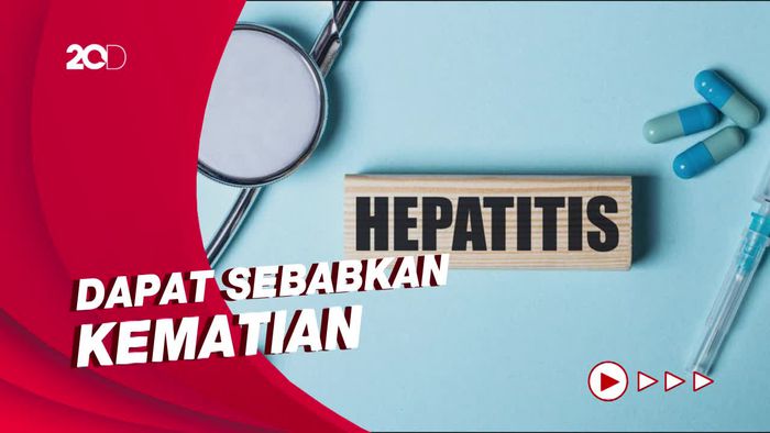 Dokter RSCM Beberkan Gejala Hepatitis Misterius yang Terjadi pada Anak
