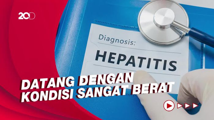 Kemenkes Bicara soal 3 Pasien yang Meninggal Diduga karena Hepatitis Misterius