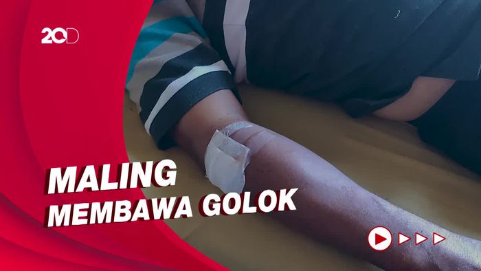 Pasutri Alami Luka Bacok usai Duel Lawan Maling di Ciamis