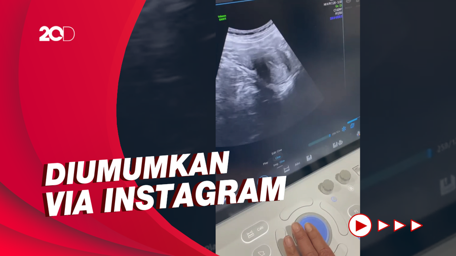 Kabar Bahagia! Istri Alvin Faiz Umumkan Sedang Hamil