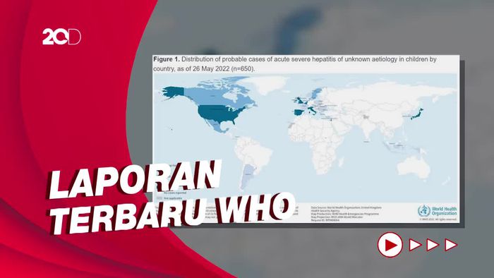 Sebaran 650 Kasus Hepatitis Akut Misterius di Dunia