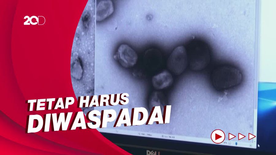 Epidemiolog: Persebaran Cacat Monyet Masih Rendah Dibanding Covid-19