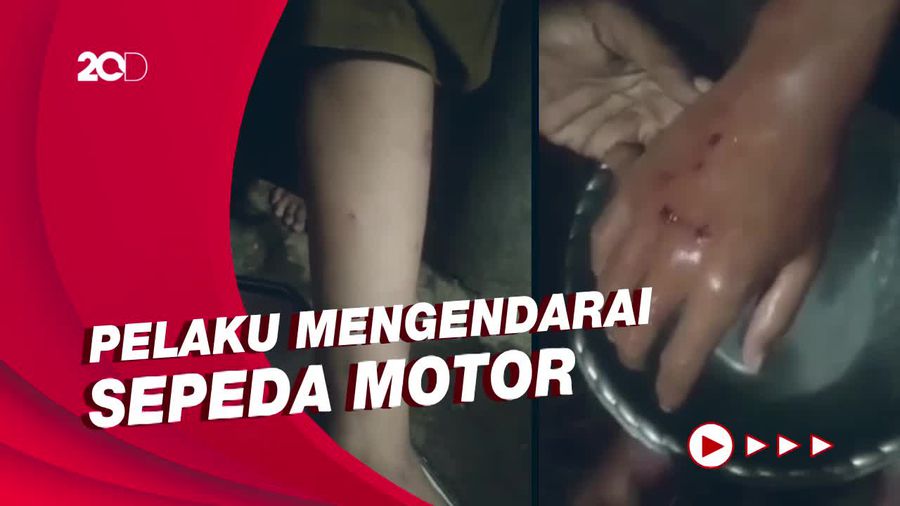 Teror Pelemparan Batu di Tasik, Tiga Santri Jadi Korban