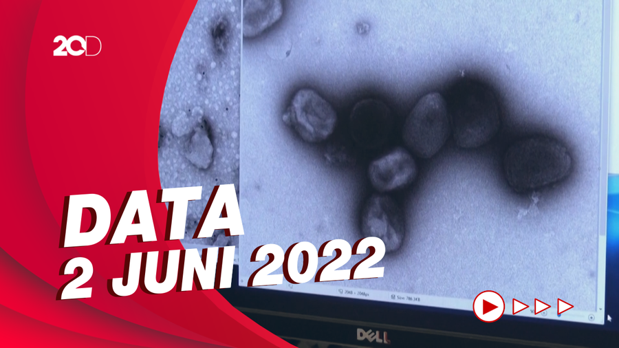 Update! WHO Konfirmasi 780 Kasus Cacar Monyet di 27 Negara