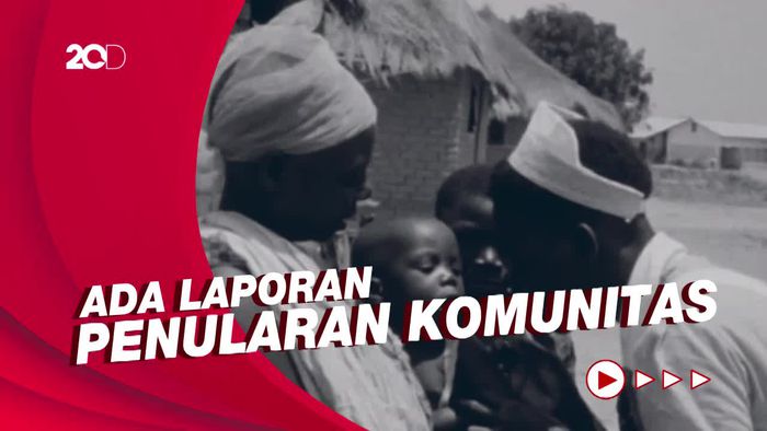 Cacar Monyet Makin Meluas, WHO Khawatirkan Anak-anak dan Wanita Hamil