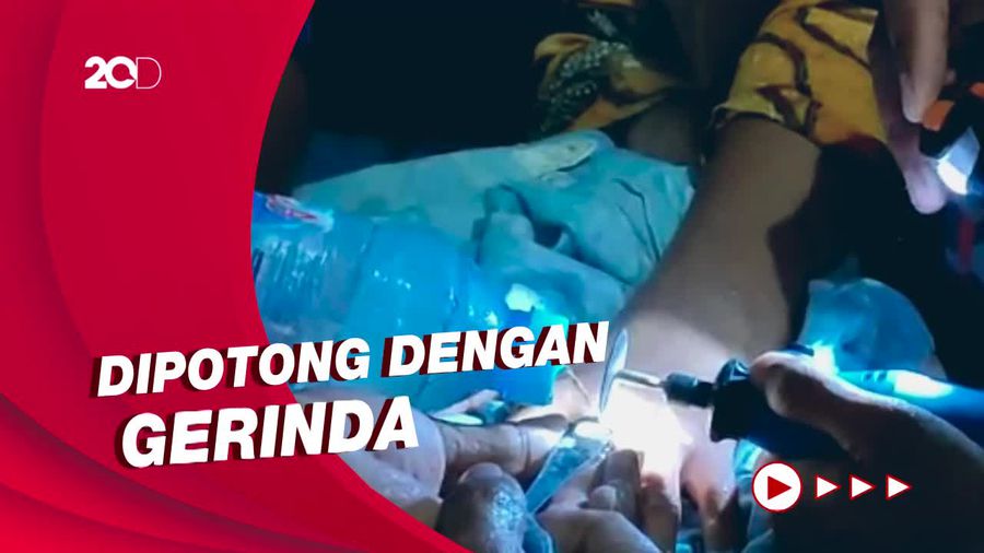 Momen Dramatis Damkar Parepare Potong Cincin di Jari Perempuan