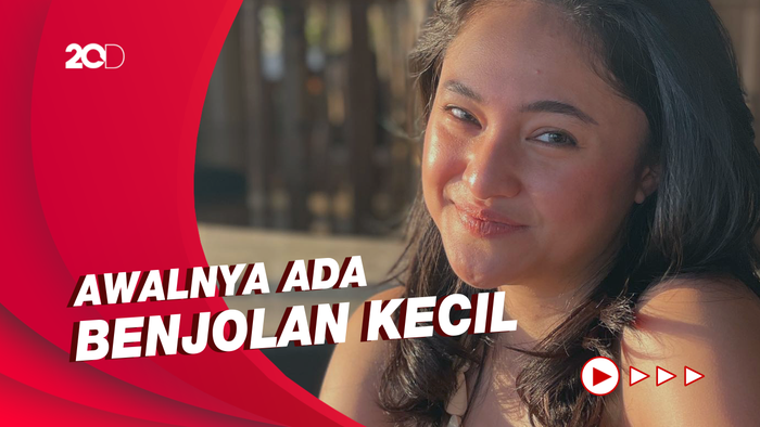  Awal Mula Marshanda Idap Tumor Payudara