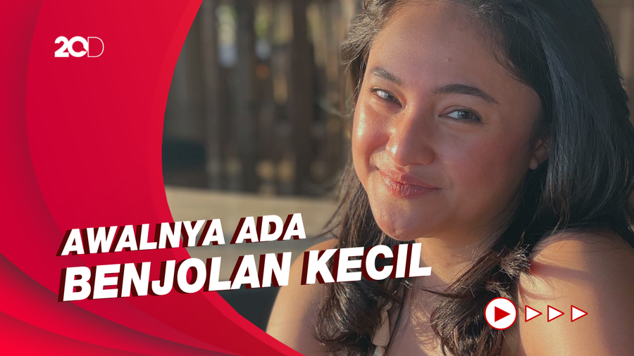  Awal Mula Marshanda Idap Tumor Payudara