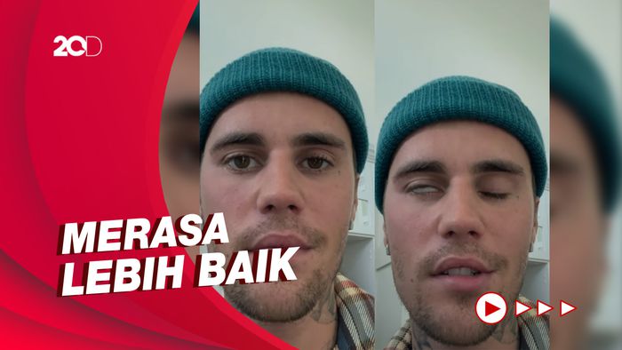  Justin Bieber Beberkan Kondisi Terkini Usai Idap Sindrom Ramsay Hunt