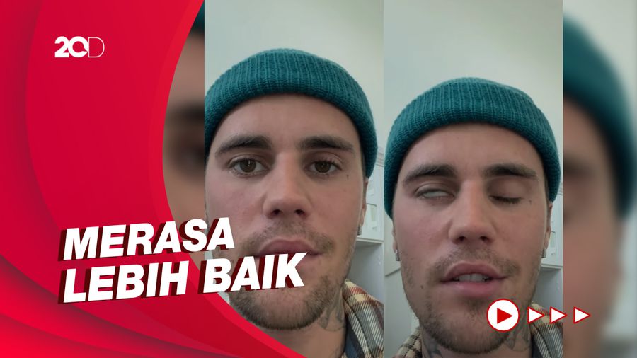  Justin Bieber Beberkan Kondisi Terkini Usai Idap Sindrom Ramsay Hunt
