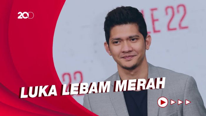 Pengacara Ungkap Hasil Visum Iko Uwais, Ada Lebam di Rusuk-Tangan Kiri