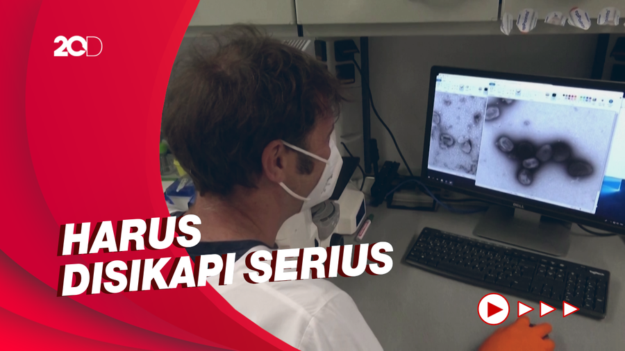 Epidemiolog Ingatkan Kasus Cacar Monyet Berpotensi Epidemi
