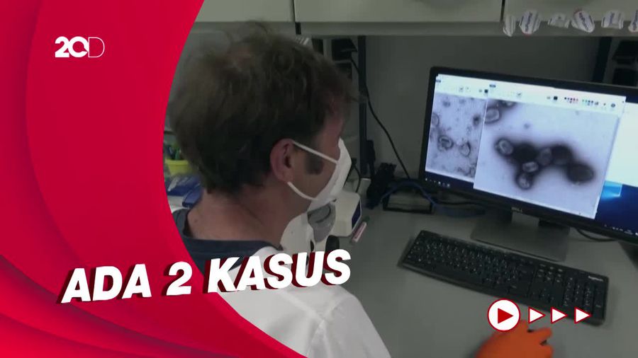 Korsel Laporkan Kasus Suspek Cacar Monyet Pertama