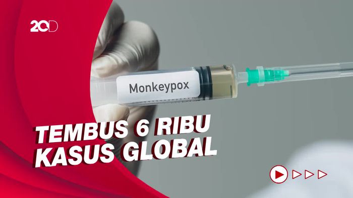 Sudah Menyebar di 58 Negara, Cacar Monyet Bakal Jadi Darurat Kesehatan?