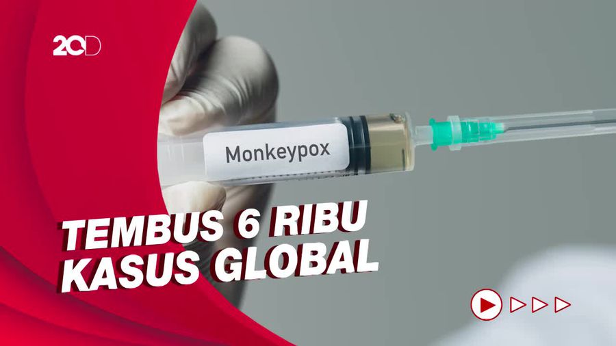 Sudah Menyebar di 58 Negara, Cacar Monyet Bakal Jadi Darurat Kesehatan?