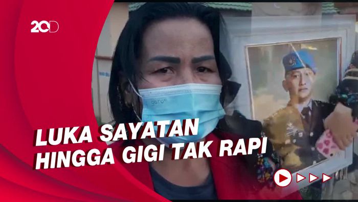 Keluarga Ungkap Sederet Kejanggalan Kondisi Jenazah Brigadir J